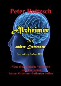 Produktbild: Alzheimer & andere Demenzen