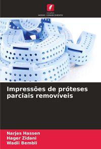 Produktbild: Impress&otilde;es de pr&oacute;teses parciais remov&iacute;veis