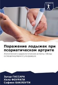 Produktbild: Porazhenie lodyzhek pri psoriaticheskom artrite