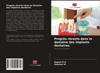 Produktbild: Progr&egrave;s r&eacute;cents dans le domaine des implants dentaires