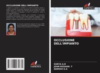 Produktbild: Occlusione Dell'impianto