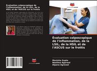 Produktbild: &Eacute;valuation colposcopique de l'inflammation, de la LSIL, de la HSIL et de l'ASCUS sur le frottis