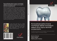 Produktbild: Koniuszkowa jedna trzecia morfologii z&iquest;b&oacute;w trzonowych sta&iquest;ych przy u&iquest;yciu techniki oczyszczania