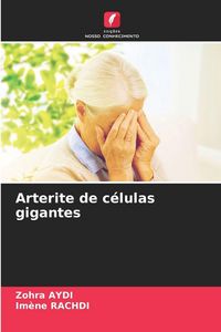 Produktbild: Arterite de c&eacute;lulas gigantes