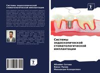 Produktbild: Sistemy &auml;ndoskopicheskoj stomatologicheskoj implantacii