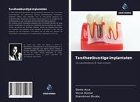 Produktbild: Tandheelkundige implantaten