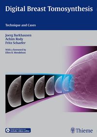 Produktbild: Digital Breast Tomosynthesis