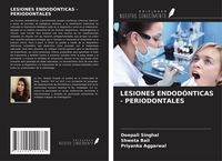 Produktbild: Lesiones Endod&oacute;nticas - Periodontales