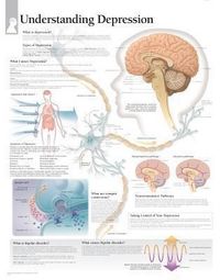 Produktbild: Understanding Depression Chart