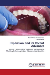 Produktbild: Expansion and its Recent Advances