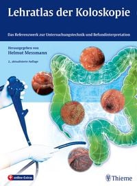 Produktbild: Lehratlas der Koloskopie