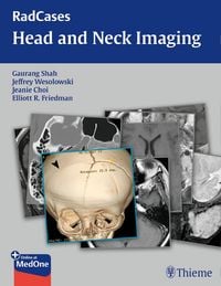 Produktbild: RadCases Head and Neck Imaging