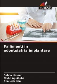Produktbild: Fallimenti in odontoiatria implantare