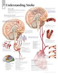 Produktbild: Understanding Stroke Chart