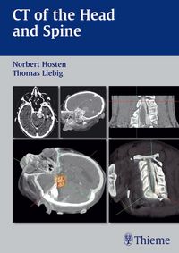 Produktbild: CT of the Head and Spine