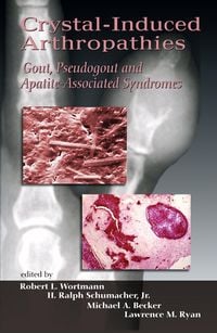 Produktbild: Crystal-Induced Arthropathies