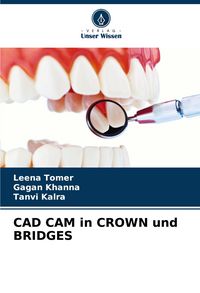 Produktbild: Cad Cam in Crown und Bridges