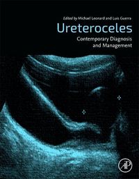 Produktbild: Ureterocoeles