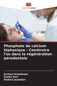 Produktbild: Phosphate de calcium biphasique : Construire l'os dans la r&eacute;g&eacute;n&eacute;ration parodontale