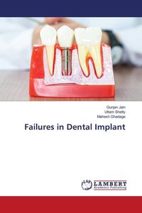 Produktbild: Failures in Dental Implant