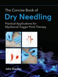 Produktbild: The Concise Book of Dry Needling