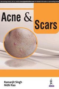 Produktbild: Acne and Scars