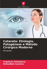 Produktbild: Catarata: Etiologia, Patog&eacute;nese e M&eacute;todo Cir&uacute;rgico Moderno