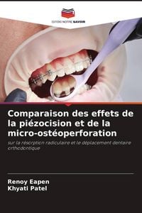 Produktbild: Comparaison des effets de la pi&eacute;zocision et de la micro-ost&eacute;operforation