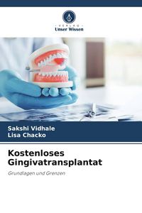 Produktbild: Kostenloses Gingivatransplantat