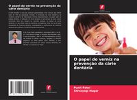 Produktbild: O papel do verniz na preven&ccedil;&atilde;o da c&aacute;rie dent&aacute;ria