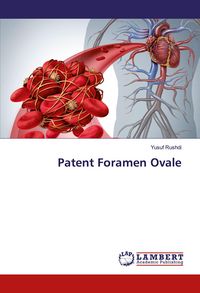 Produktbild: Patent Foramen Ovale