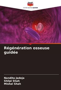 Produktbild: R&eacute;g&eacute;n&eacute;ration osseuse guid&eacute;e