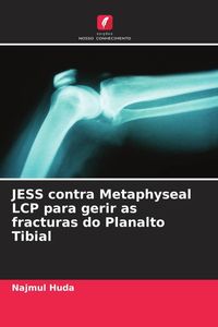 Produktbild: JESS contra Metaphyseal LCP para gerir as fracturas do Planalto Tibial