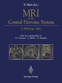 Produktbild: MRI of the Central Nervous System