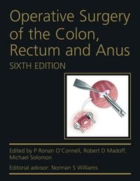 Produktbild: Operative Surgery of the Colon, Rectum and Anus