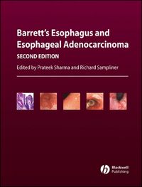 Produktbild: Barrett's Esophagus and Esophageal Adenocarcinoma
