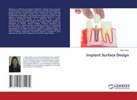 Produktbild: Implant Surface Design