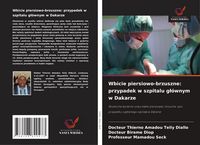 Produktbild: Wbicie piersiowo-brzuszne: przypadek w szpitalu g&iquest;&oacute;wnym w Dakarze