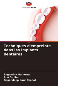 Produktbild: Techniques d'empreinte dans les implants dentaires