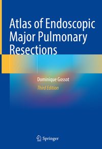 Produktbild: Atlas of Endoscopic Major Pulmonary Resections