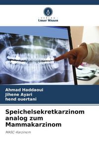 Produktbild: Speichelsekretkarzinom analog zum Mammakarzinom
