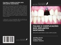 Produktbild: Falhas E Complica&ccedil;&otilde;es Dos Implantes Dent&aacute;rios