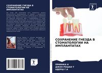 Produktbild: Sohranenie Gnezda V Stomatologii Na Implantatah