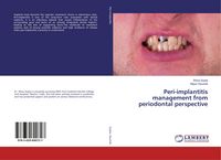 Produktbild: Peri-implantitis management from periodontal perspective