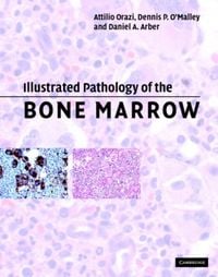 Produktbild: Illustrated Pathology of the Bone Marrow