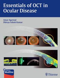 Produktbild: Essentials of OCT in Ocular Disease