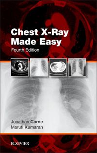 Produktbild: Chest X-Ray Made Easy E-Book