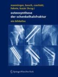 Produktbild: Osteosynthese der Schenkelhalsfraktur
