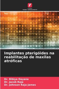 Produktbild: Implantes pterig&oacute;ides na reabilita&ccedil;&atilde;o de maxilas atr&oacute;ficas