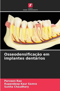 Produktbild: Osseodensifica&ccedil;&atilde;o em implantes dent&aacute;rios